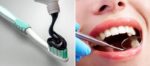 New Toothpaste Is A Breakthrough In Treating Cavities